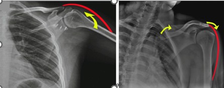 fig 4 articolo colonna catene