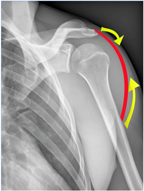 fig. 3 articolo catene