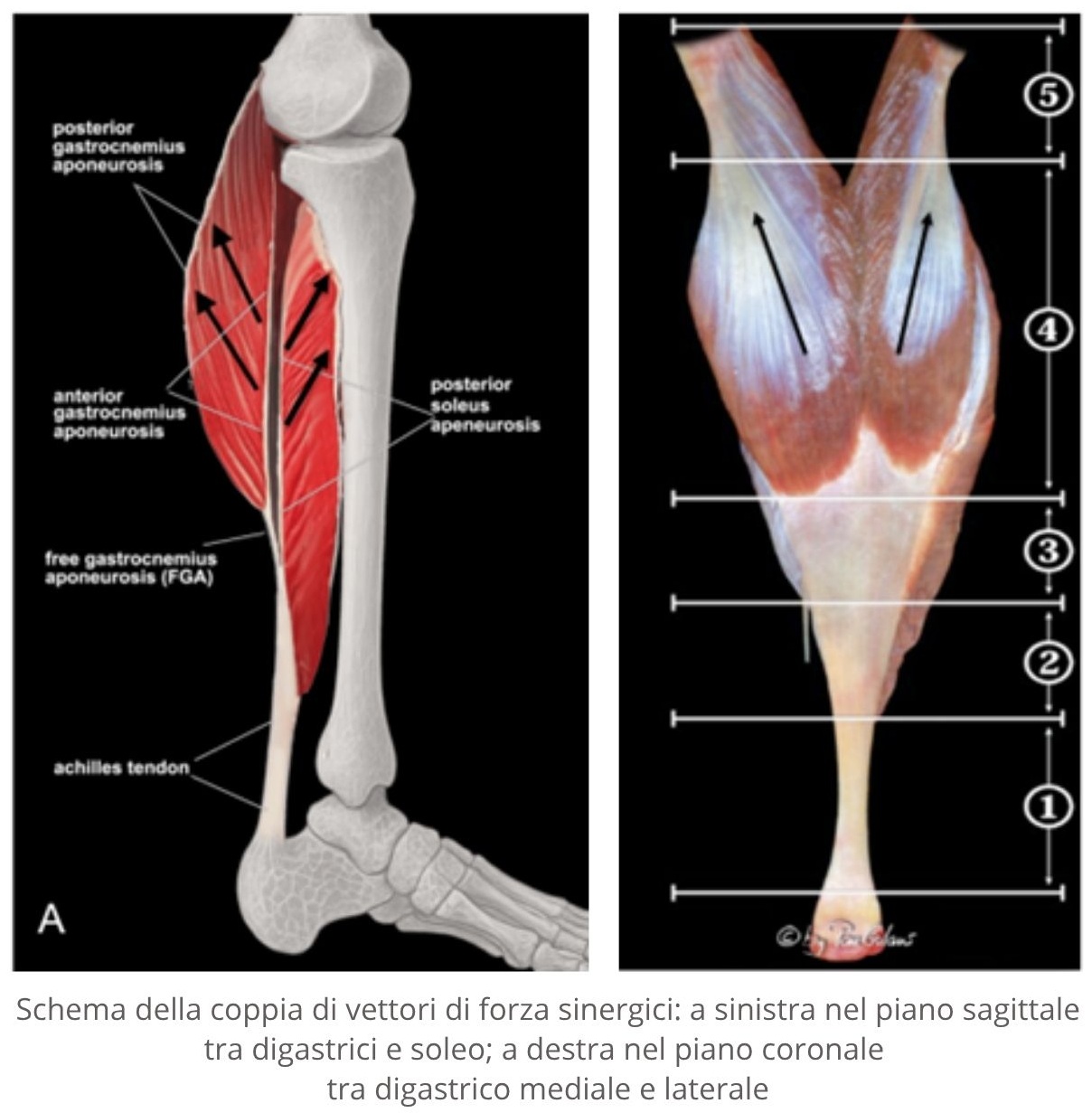 schema della coppia di vettori di forza sinergici a sinistra nel piano sagittale tra digastrici e soleo a destra nel piano coronale tra digastrico mediale e laterale