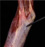 Patologia muscolo tendinea va rivisitata Anatomia Importanza delle catene miofasciali 010 spine center