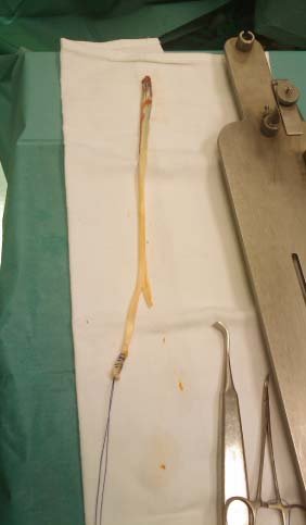 Patologia muscolo tendinea va rivisitata Anatomia Importanza delle catene miofasciali 007 spine center