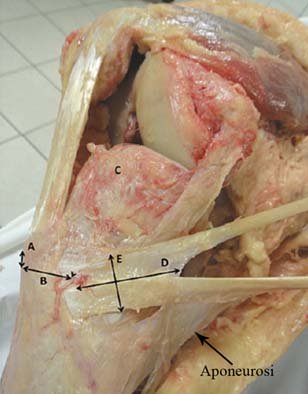 Patologia muscolo tendinea va rivisitata Anatomia Importanza delle catene miofasciali 008 spine center