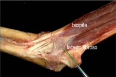 Patologia muscolo tendinea va rivisitata Anatomia Importanza delle catene miofasciali 011 spine center