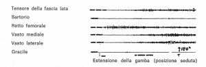 Condropatia femoro rotulea e rinforzo muscolare 003 spine center