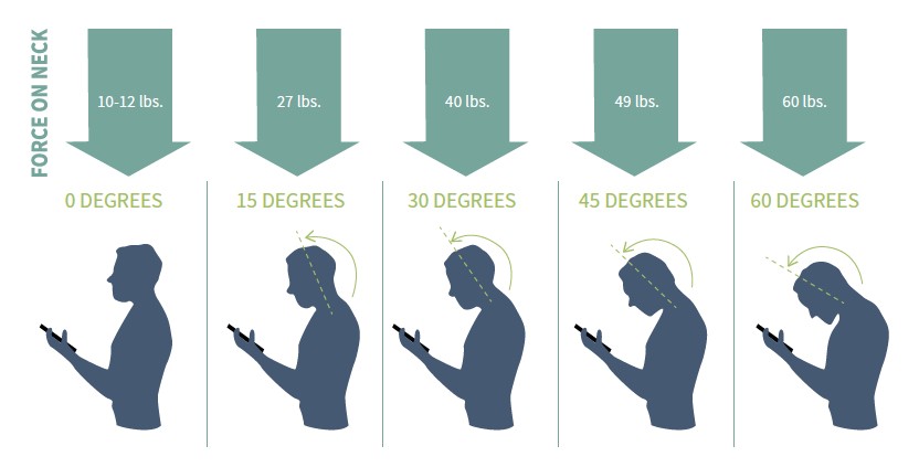 TEXT NECK: LA SINDROME ‘’TECNOLOGICA’’