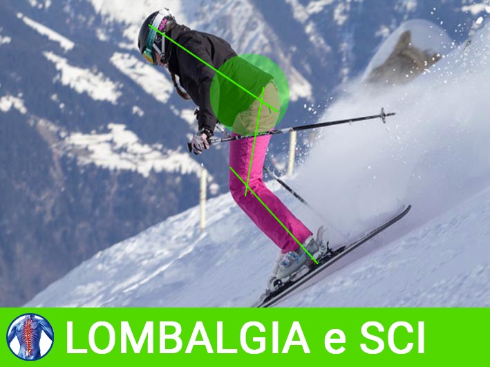 Lombalgia & Sci
