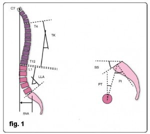 Lombalgia Sci 002 spine center