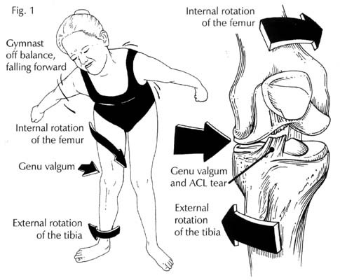 Osteopatia linfluenza viscerale sui traumi del ginocchioA 002 spine center