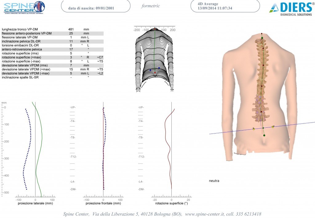SCOLIOSI valutazione della colonna senza raggi X Formetric 004 spine center