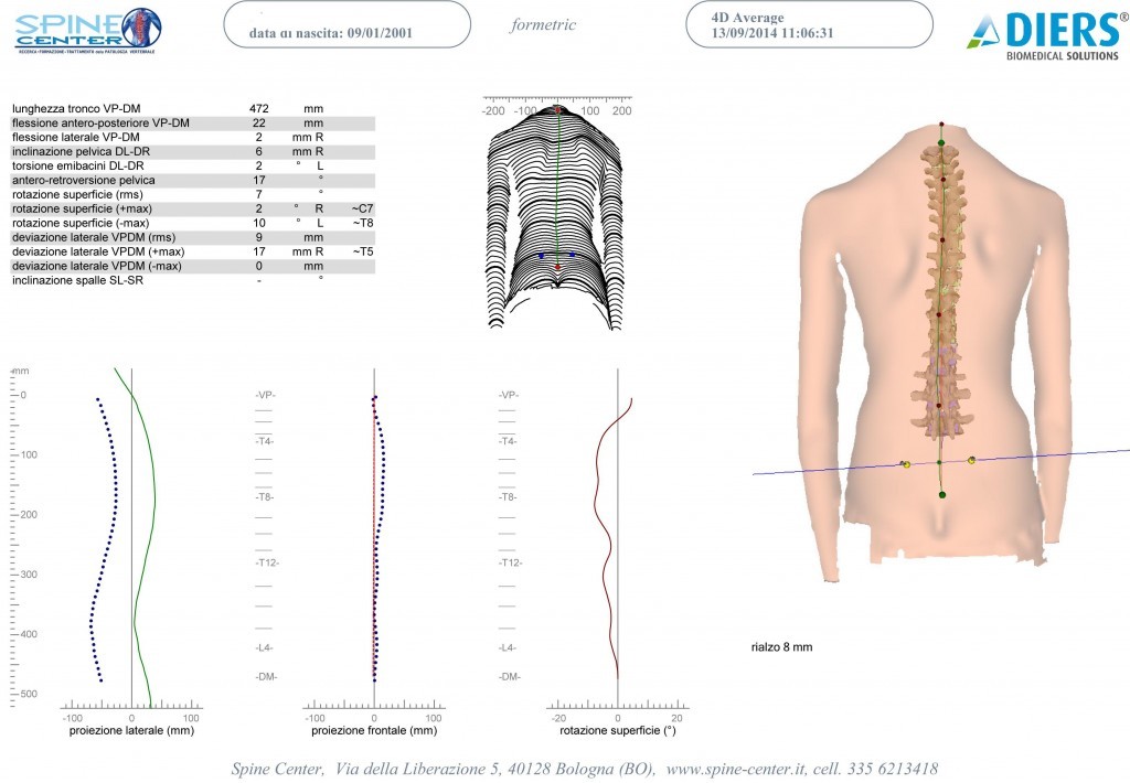 SCOLIOSI valutazione della colonna senza raggi X Formetric 006 spine center