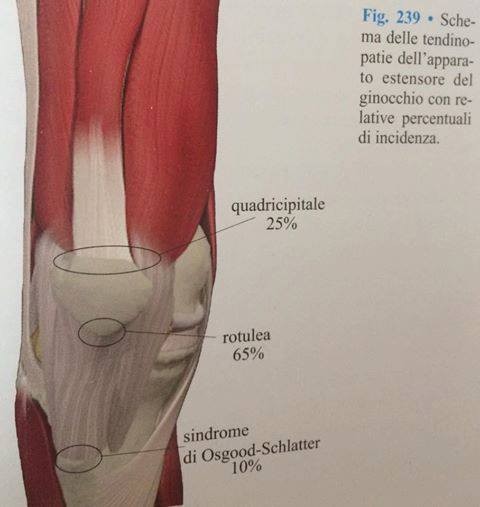 Ginocchio del Saltatore dal Eziopatogenesi alle recenti evidenze sugli effetti analgesici delle contrazioni isometriche 001 spine center