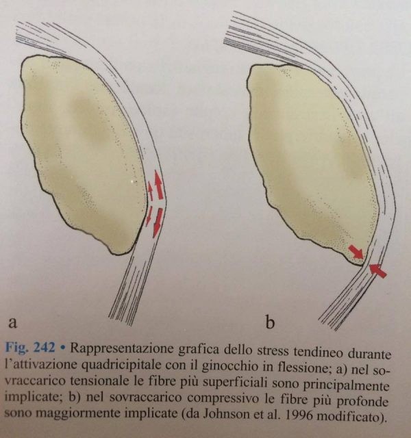 Ginocchio del Saltatore dal Eziopatogenesi alle recenti evidenze sugli effetti analgesici delle contrazioni isometriche 003 spine center