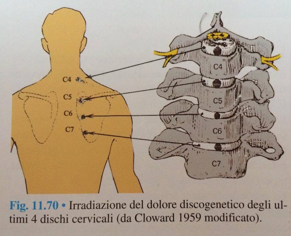 Auto trattamento dolore cervicale