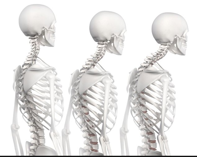 Diaframma RMN e patologia vertebrale 005 spine center