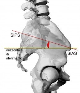 CONSIDERAZIONI SULLANGOLO DI INCIDENZA PELVICA 003 spine center