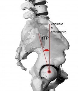 CONSIDERAZIONI SULLANGOLO DI INCIDENZA PELVICA 004 spine center