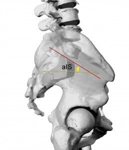 CONSIDERAZIONI SULLANGOLO DI INCIDENZA PELVICA 005 spine center