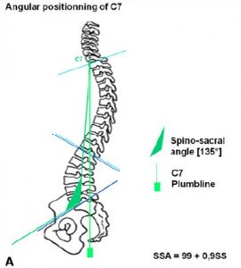Il Rachide sul Piano Sagittale 002 spine center