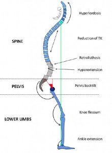 Il Rachide sul Piano Sagittale 005 spine center