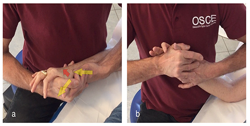 terapia manuale rizoartrosi