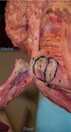 Legamento Sacro Tuberoso considerazioni anatomo cliniche 006 spine center