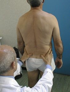 Revisione critica del test di flessione in piedi e seduto 002 spine center
