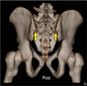 Revisione critica del test di flessione in piedi e seduto 006 spine center