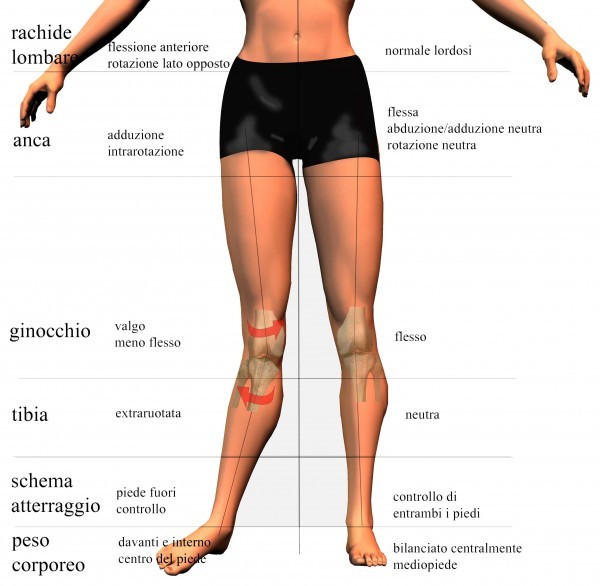 Prevenzione della lesione del LCA del ginocchio 002 spine center