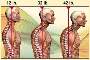 Diaframma e patologie correlate 002 spine center
