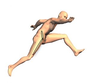 Hip Spine Syndrome relazione anca rachide lombare nel LBP 002 spine center