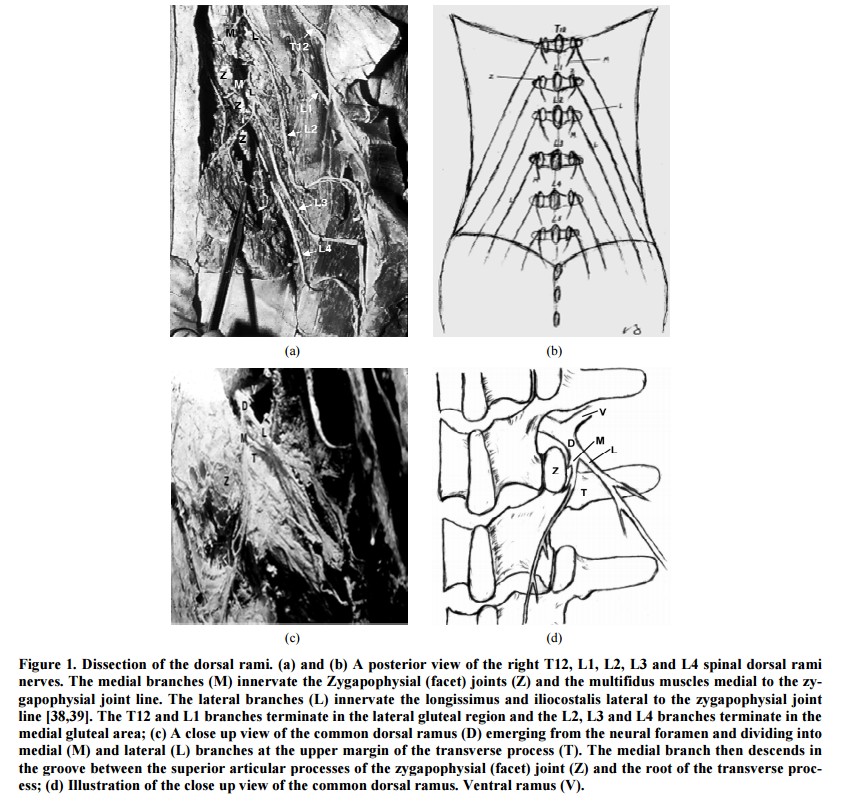 La Sindrome Del Ramo Dorsale nel mal di schiena Cosa sappiamo 001 spine center