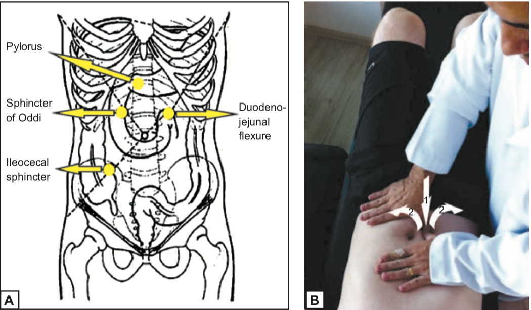 Malattia da reflusso gastro esofageo e terapia manuale 07 spine center