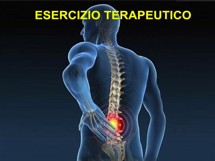 Mal di schiena: approccio mediante l'esercizio terapeutico