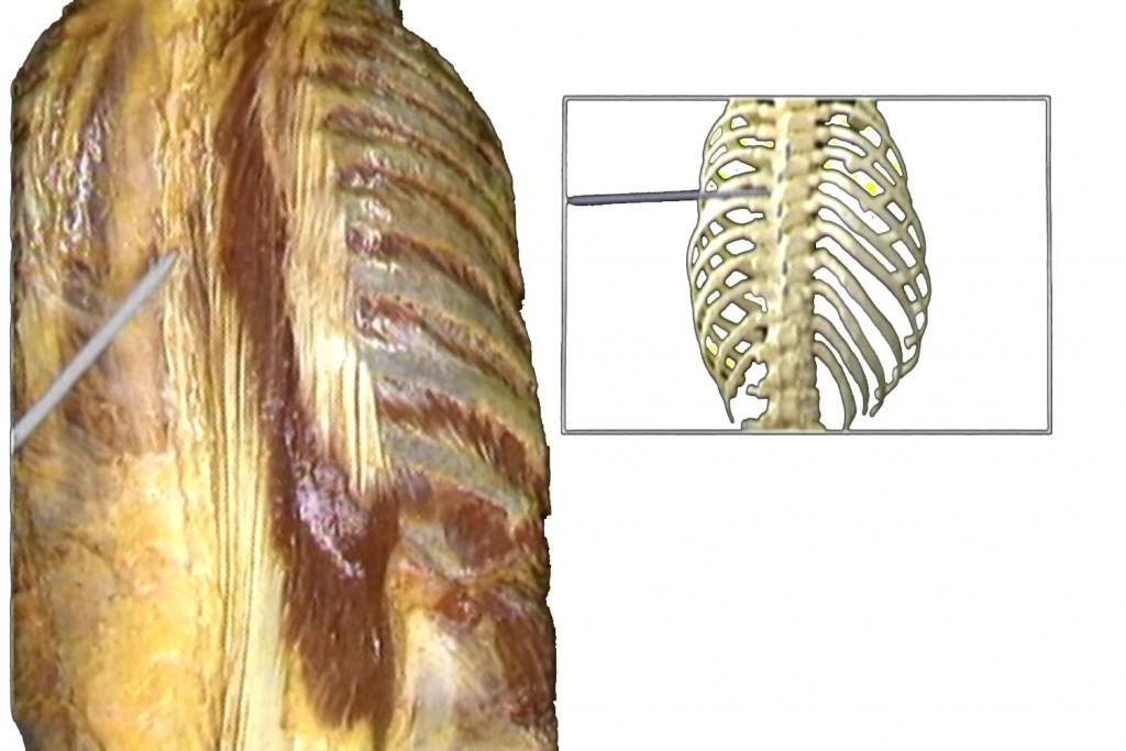Diaframma Toracico funzione 008 spine center