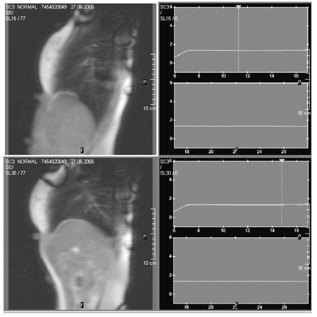 Diaframma Toracico funzione 003 spine center