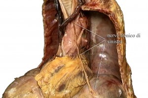Diaframma Toracico Anatomia 006 spine center
