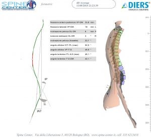 Tacchi e lombalgie quando la rete fa disinformazione 004 spine center