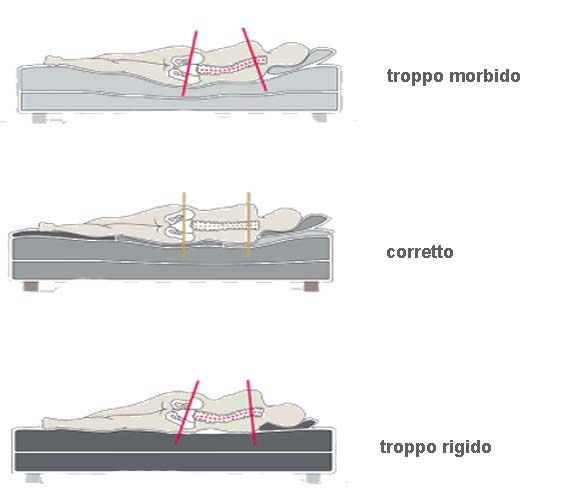 Considerazioni sul materasso per il mal di schienai 002 spine center