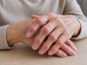 Noduli di Heberden: cosa sono e quando preoccuparsi