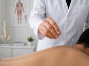 Un medico esegue un trattamento di agopuntura sulla schiena di un paziente all’interno di un ambulatorio medico moderno e luminoso.