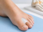 Ortesi interdigitale in silicone su misura applicata tra le dita del piede per ridurre sfregamenti, pressioni e migliorare il comfort durante il movimento.