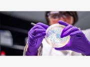 Trapianto di cellule staminali e PRP