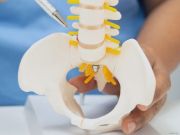 stenosi-del-canale-vertebrale-sintomi-cause-e-quando-rivolgersi-al-neurochirurgo