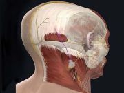Cefalea Cervicogenica e Catena Miofasciali Posteriore