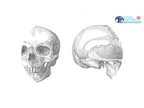 Interpretare la radiologia dal punto di vista della terapia manuale/osteopatia 